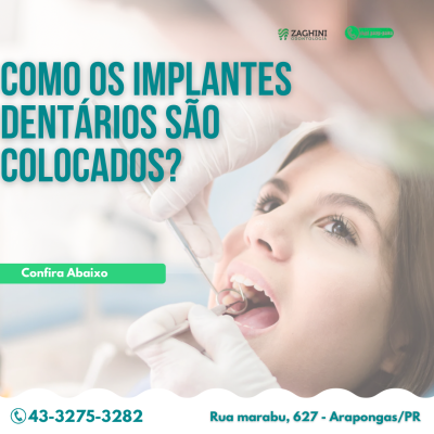 Zaghini Odontologia Implantes Dentários Ortodontia 
